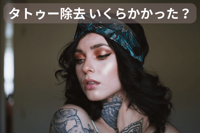 タトゥー除去はいくらかかった?