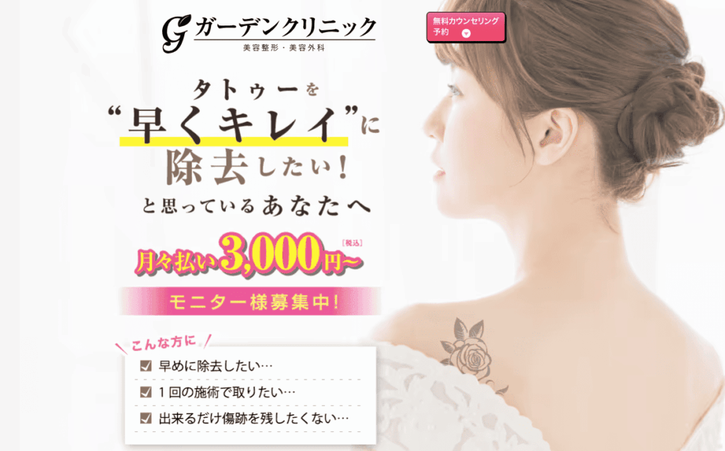ガーデンクリニックのタトゥー除去